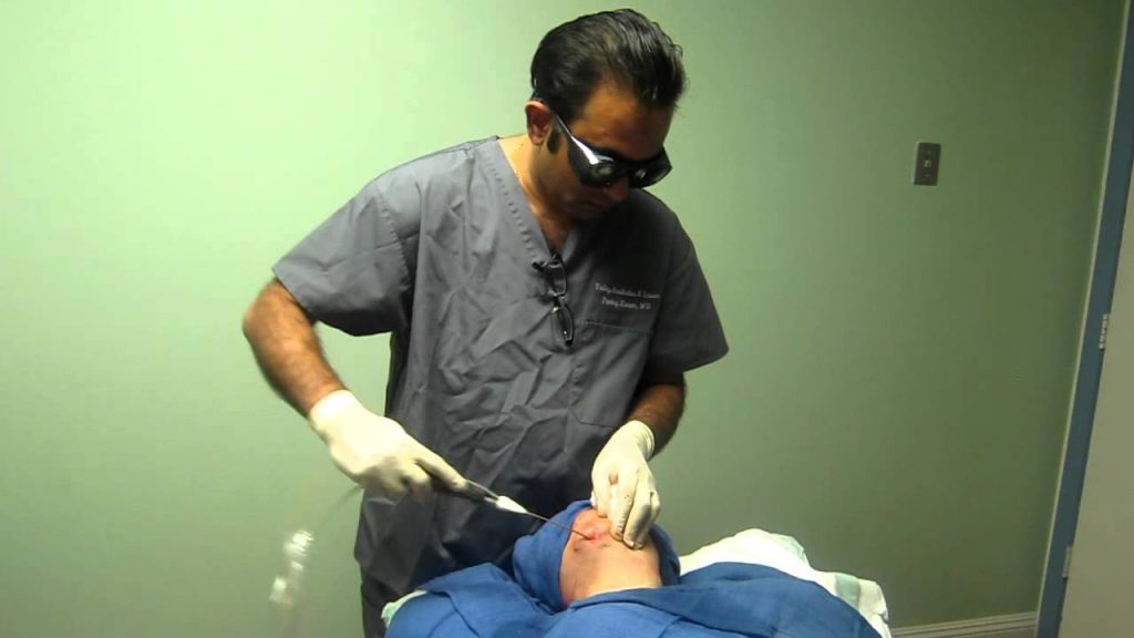 Dr. Sanjay Lalla Laser Liposuction
