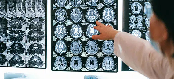 Doctor approved PEMF therapy Glen Burnie MD